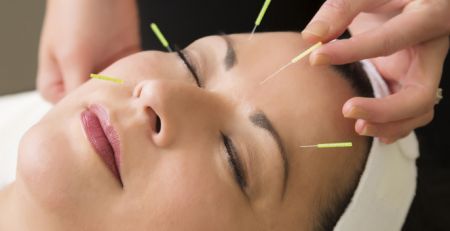 Burlington Chiro - Acupuncture Facial